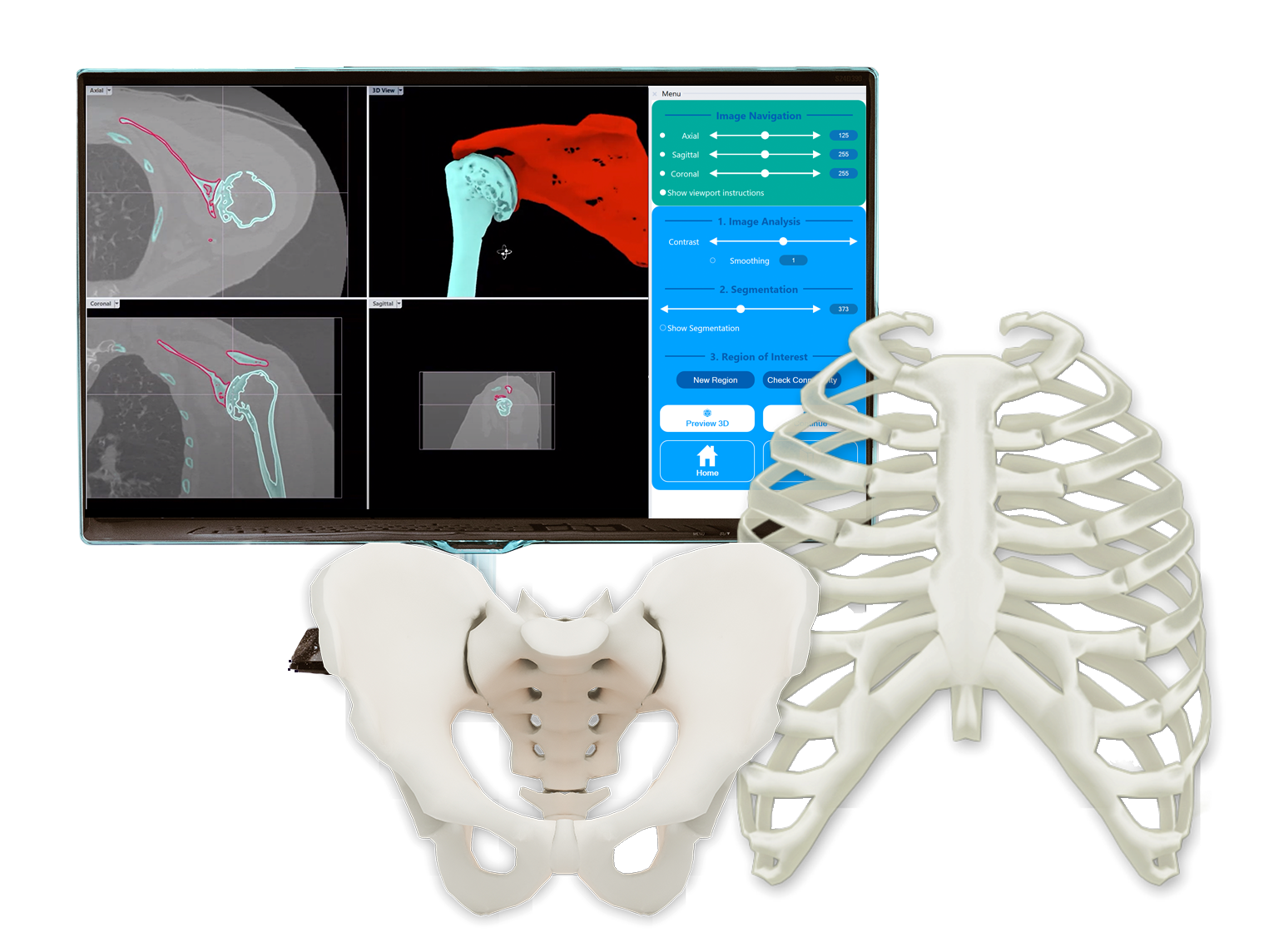 Journées Découverte Rhino et Rhino3DMedical à Toulouse, par Kallisto